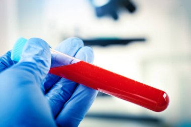 Laboratuvarda Coronavirus. Kan Testi yapan bir bilim adamı. Yeni Salgın Coronavirüs 2019 nCoV. Kopyalama alanı olan arkaplan.