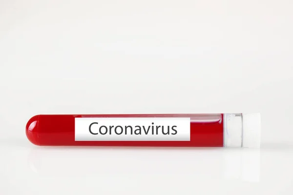 Testbuis met bloed en witte sticker op wit. Achtergrond met kopieerruimte. Coronavirus. Horizontaal. — Stockfoto