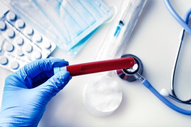 Coronavirüs salgını. Elinde bir şişe kan tutan bir doktorun eli..