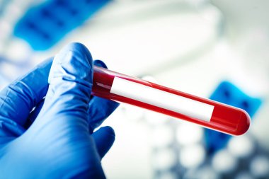 Laboratuvarda Coronavirus. Kan Testi yapan bir bilim adamı. Yeni Salgın Coronavirüs 2019 nCoV. Kopyalama alanı olan arkaplan.