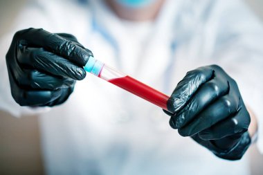 Coronavirüs salgını. Elinde bir şişe kan tutan bir doktorun eli..