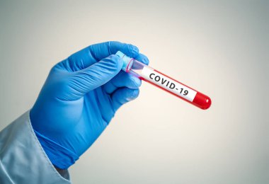 Laboratuvarda Coronavirus. Kan Testi yapan bir bilim adamı. Yeni Salgın Coronavirüs 2019 nCoV. Kopyalama alanı olan arkaplan.