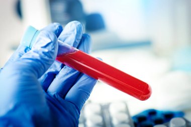 Laboratuvarda Coronavirus. Kan Testi yapan bir bilim adamı. Yeni Salgın Coronavirüs 2019 nCoV. Kopyalama alanı olan arkaplan.