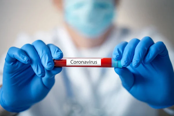 De epidemie van het coronavirus. De dokter doet een bloedtest.. — Stockfoto