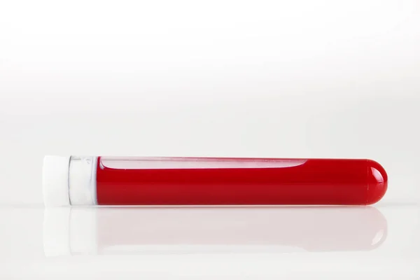 Reagenzglas mit Blut und weißem Aufkleber auf weißem Grund. Hintergrund mit Kopierraum. Coronavirus. Horizontal. — Stockfoto