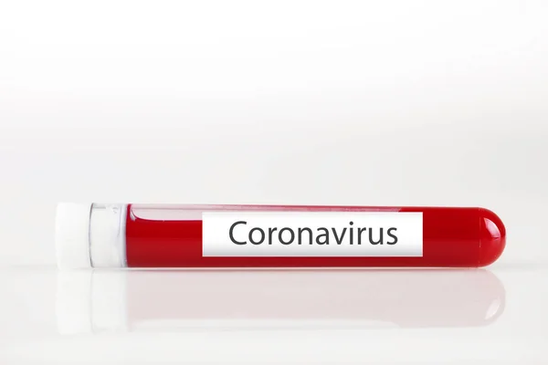 Testbuis met bloed en witte sticker op wit. Achtergrond met kopieerruimte. Coronavirus. Horizontaal. — Stockfoto