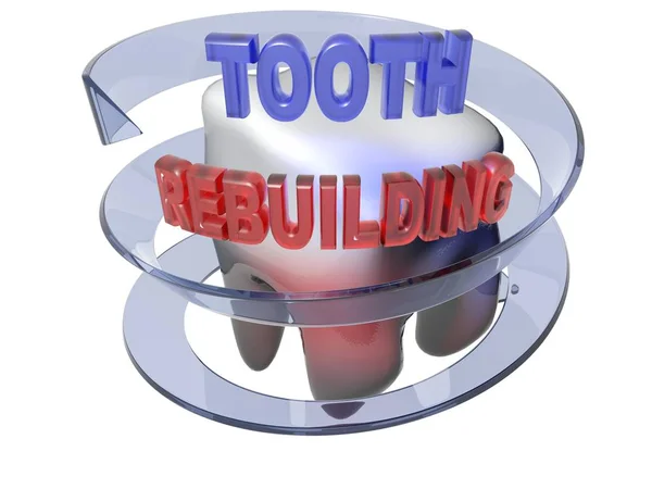 Ανακατασκευή - 3d rendering δόντι — Φωτογραφία Αρχείου