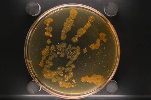 Petri dish with a colony of bacteria on a hand