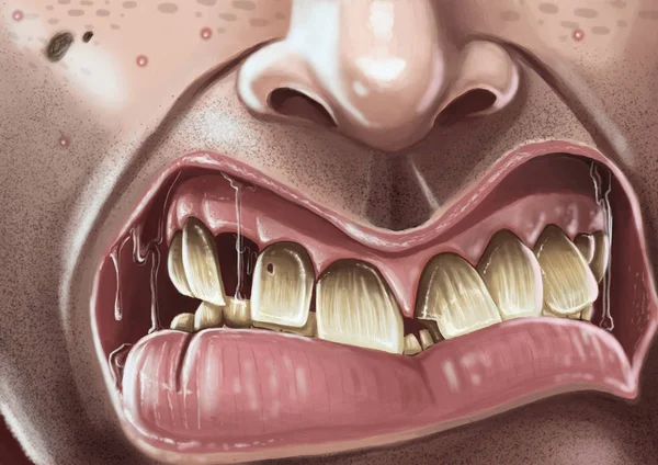 Grommende man met slechte tanden — Stockfoto