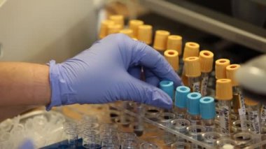 Tıbbi laboratuvar test tüpleri işaretleme