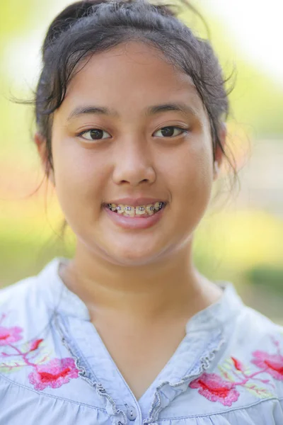 Primer plano cabeza de asiático adolescente edad con frenos dental dientes —  Fotos de Stock