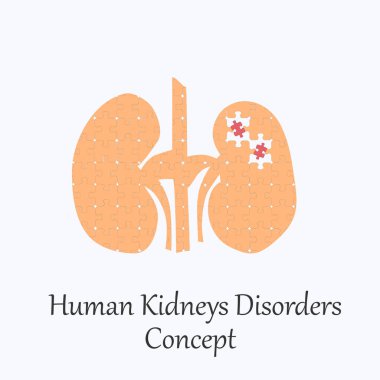 Bulmaca Kalıbıyla Dolu İnsan Böbrekleri