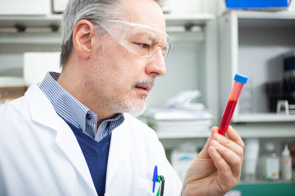 Medical scientist researcher looking at a blood tube, coronavirus blood test concept