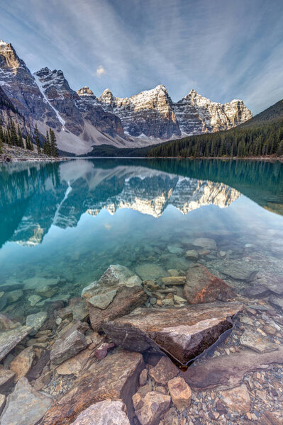 The Iconic Moraine Lake
