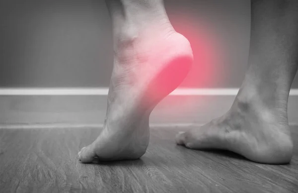 Zbliżenie Bólu Pięty Red Spot Plantar Fasciitis Kobiece Stopy — Zdjęcie stockowe