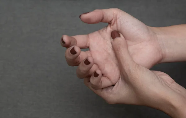Закрыть Женскую Руку Страдающую Боли Боль Ладони Hnad Hurting — стоковое фото