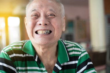 Gülümseyen son sınıf öğrencisi metal tacıyla dişlerini gösteriyor.