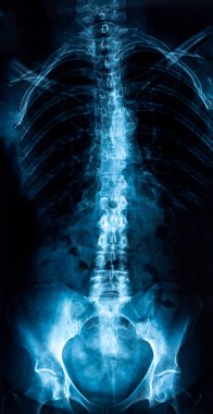 Gövde x-ray