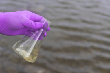 Nehirden bir su örneği. Eldiven takıp test tüpünde su topluyor. ekoloji kavramı