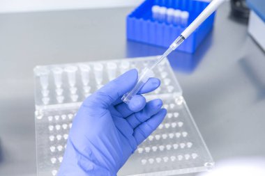 Laboratuvarda kan örneğiyle çalışan bilim adamı. Yeni hızla yayılan Corona virüsü salgını için bir kan testi sonucu. Coronavirus aşısı geliştirme.