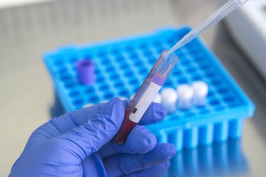 Araştırma laboratuvarında kan tüpü testi yapan doktor. Corona virüsü salgını aşısı geliştirme konsepti.