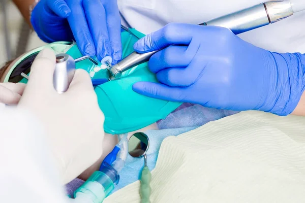 Close-up de um dentista tratar os dentes — Fotografia de Stock
