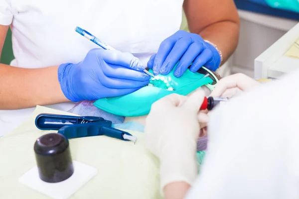 Bir diş hekimi Close-Up diş tedavi — Stok fotoğraf