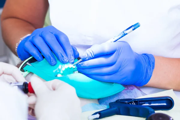 Bir diş hekimi Close-Up diş tedavi — Stok fotoğraf