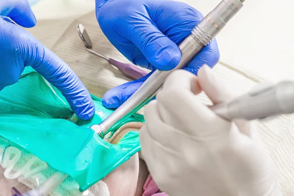 Närbild av en tandläkare behandla tänder — Stockfoto