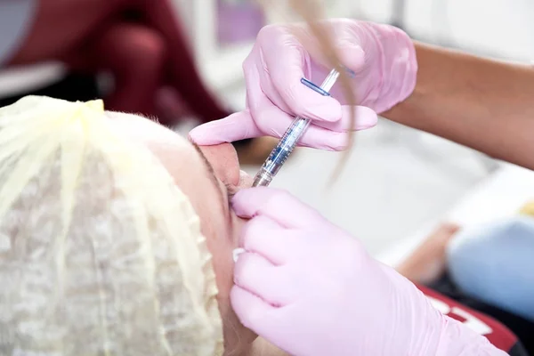 Close Uma Mulher Cosmetician Injetando Uma Injeção Botox Nas Maçãs — Fotografia de Stock
