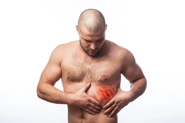 Injury Rib Young Bald Man Sportive Physique Holds Sore Rib — Stock Photo, Image