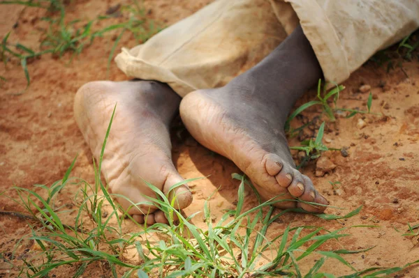 Pés nus descansando no campo Africano — Fotografia de Stock