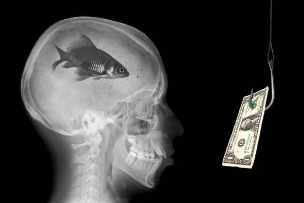 Radiografía del cráneo con peces en el cerebro —  Fotos de Stock