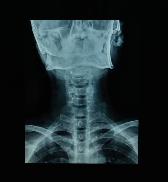 黒の背景に人間の頭蓋骨の X 線ファイル — ストック写真