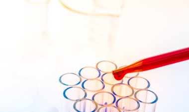 laboratuvar test tüpleri, tıbbi Züccaciye Mağazaları. (Filtre uygulanmış resim prosedürü