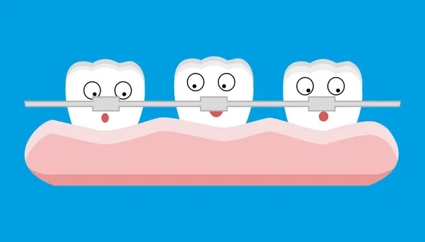 Dessin animé orthèses dentaires. Illustration vectorielle — Image vectorielle