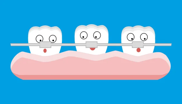 Kreskówka ząb nawiasy klamrowe. Ilustracja wektorowa — Wektor stockowy