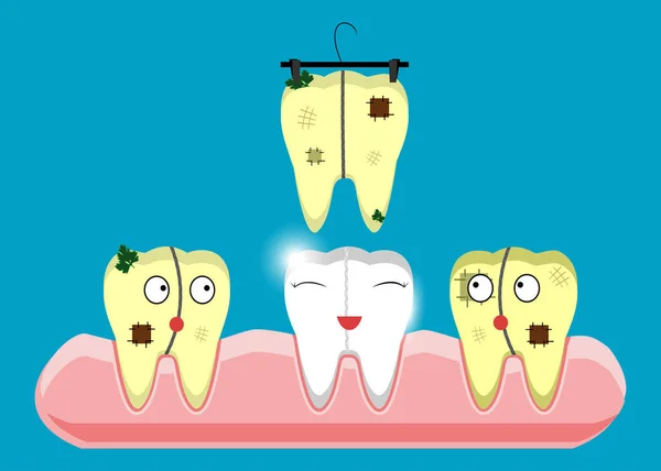 Uppsättning tänder rengöring och blekning begrepp. Scaler, laser, mekaniska, färg. Cartoon dental vektorillustration. — Stock vektor