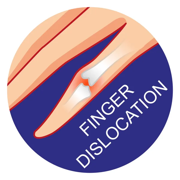 Vinger dislocatie pictogram vector — Stockvector