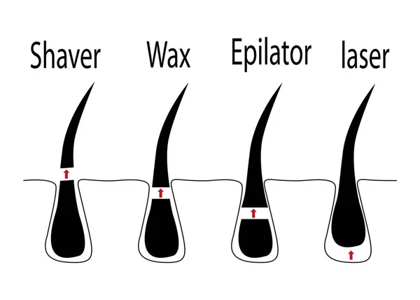 Vektorový diagram různých metod odstraňování chlupů — Stockový vektor