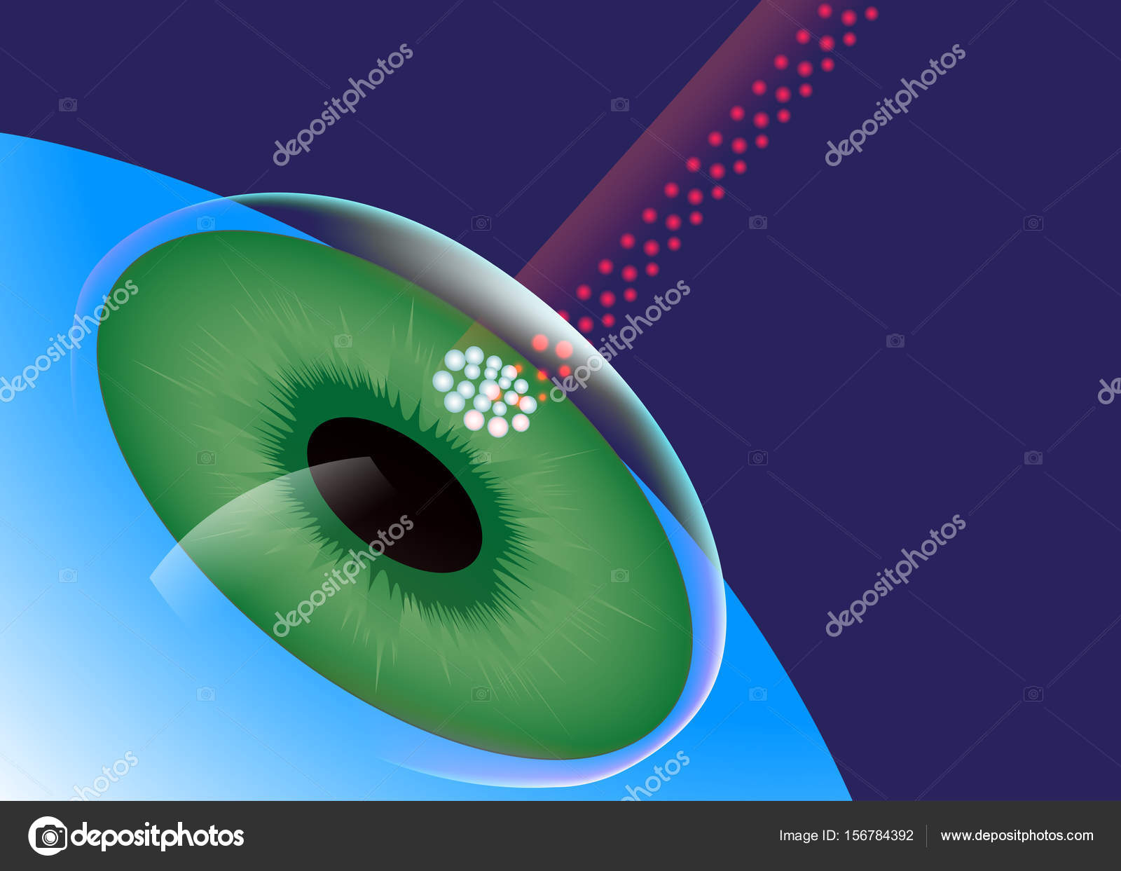 LASIK, Eye Center, Laser Eye Surgery Stock Vector Image by ©slobodyan_78 #156784392 LASIK, Eye Center, Laser Eye Surgery Stock Vector Image by ©slobodyan_78 #156784392