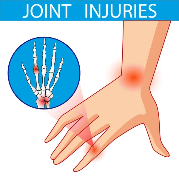 Dolor articular. Dibujos animados vector ilustración . — Archivo Imágenes Vectoriales