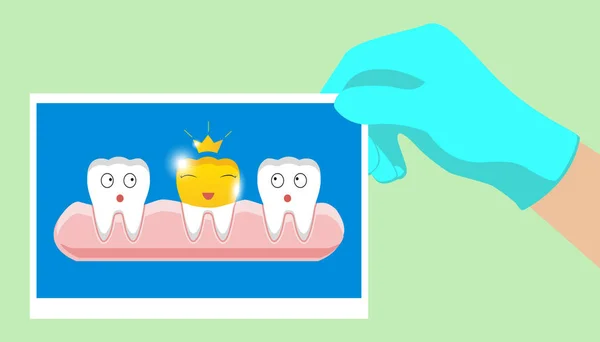 Ząb ze złotą ikoną dental korony w stylu kreskówka na białym tle — Wektor stockowy