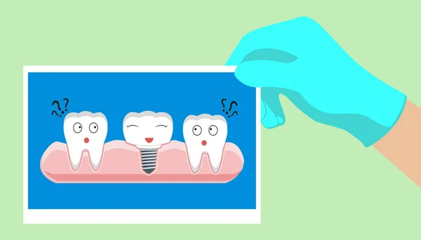 Rajzfilm fogászati implantátum és a fogak. Mosolygó fogak és fogászati implantátum. Vicces vektoros illusztráció — Stock Vector