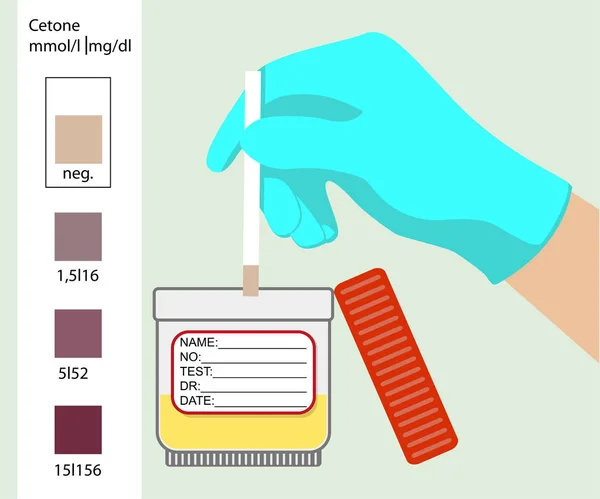 Aceton-Test. medizinischer Schnelltest. Ketone. Diagnosetest — Stockvektor