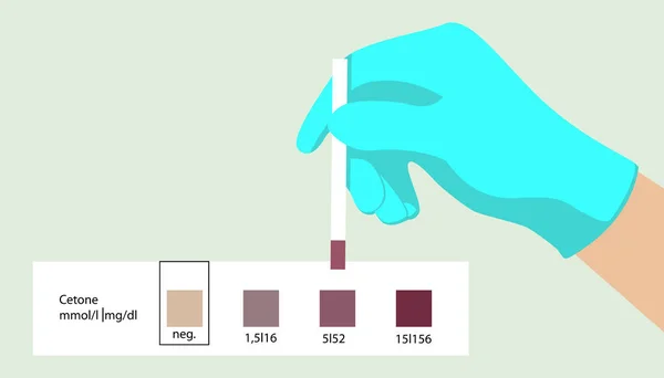 Aceton test. Medicinsk express test. Ketoner. Diagnostiska testet — Stock vektor