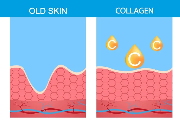 Colágeno, piel vector de piel, estructura, edad, envejecimiento, belleza, cuerpo, dermatología, epidermis — Vector de stock