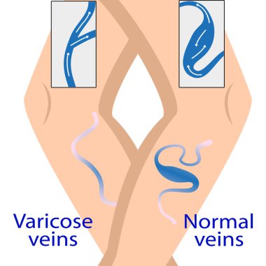 Varis insan, bilim, bakım, sağlık, tıp, vücut, sistem
