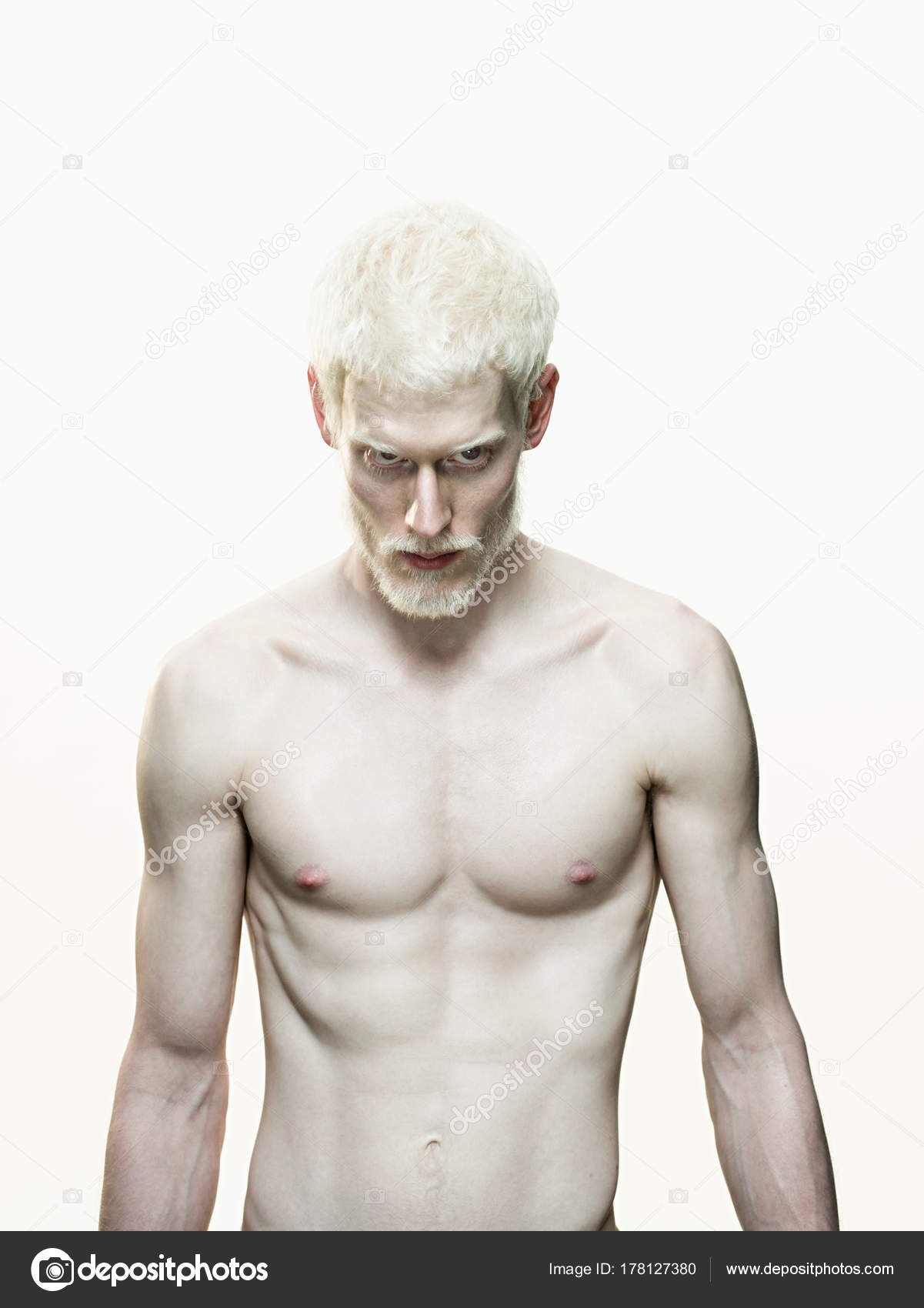 Naked Albino Man