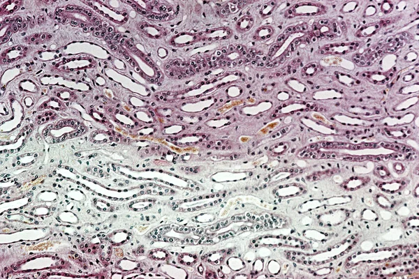 Κάτω Από Την Υψηλή Μεγέθυνση Μικροσκοπική Προβολή Του Νεφρού — Φωτογραφία Αρχείου